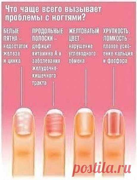 Диагностика здоровья по ногтям