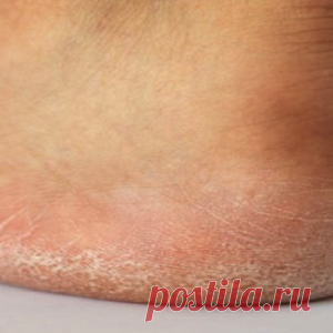 10 признаков того, что у вас может возникнуть проблема со щитовидной железой и 10 вещей, которые вы можете сделать по этому поводу