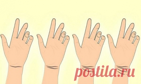 Знаки на руке, с которыми мы родились могут рассказать о нашей судьбе Тело подобно таинственной карте нашего собственного существования. Каждый знак или деталь, независимо от того, насколько малы, имеют значение. Например, хирургический шрам рассказывает о медицинской операции в нашем прошлом, о проблеме, которую мы решили, но также о боли и даже слезах.