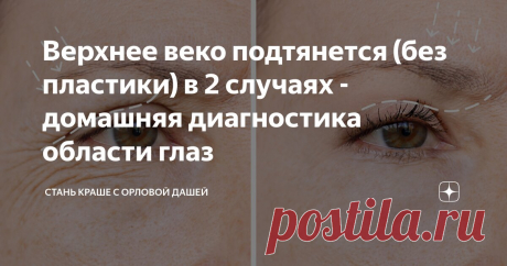 Верхнее веко подтянется (без пластики) в 2 случаях - домашняя диагностика области глаз Статья автора «Стань краше с Орловой Дашей» в Дзене ✍: Если в юности ваши глаза не прятались под верхним веком, а нависание стало заметно лишь с возрастом - то эта статья для Вас.