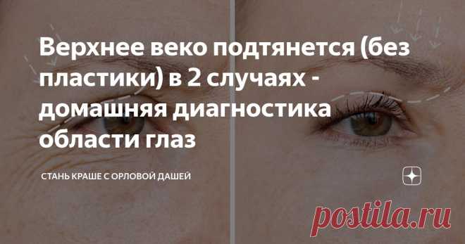 Верхнее веко подтянется (без пластики) в 2 случаях - домашняя диагностика области глаз Статья автора «Стань краше с Орловой Дашей» в Дзене ✍: Если в юности ваши глаза не прятались под верхним веком, а нависание стало заметно лишь с возрастом - то эта статья для Вас.