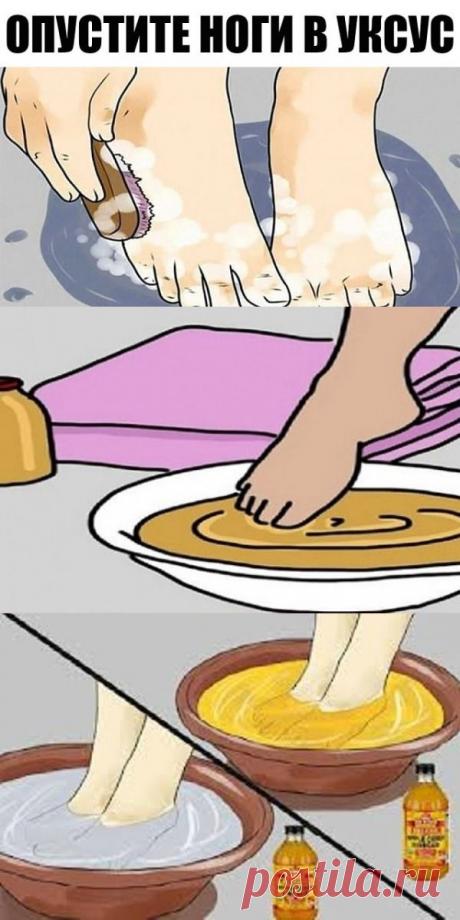 Опустите ноги в яблочный уксус — и болезни уйдут! Сами в шоке!! Это просто восхитительно!