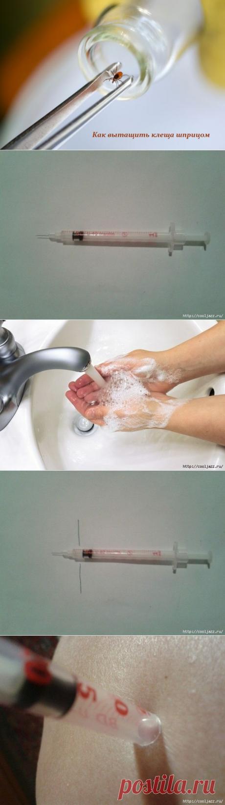 Как вытащить клеща шприцом.
