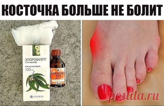 Косточка больше не болит! Потратила мелкие деньги на 2 средства, эффект невероятен!

Делюсь рецептом от операционной медсестры!

Помню, как однажды на уроке биологии почувствовала себя по-настоящему ужасно. Мы изучали что-то связанное с генетикой, и учительница рассказывала нам о том, какие генетические заболевания передаются по наследству.

В качестве яркого примера она привела косточку на ноге. Увеличенная косточка, некрасивая и болезненная, как подробно расписывала преп...