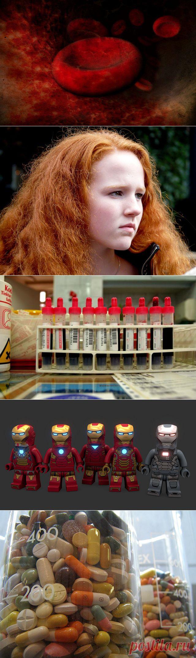 Анемия: причины, симптомы, степени, лечение