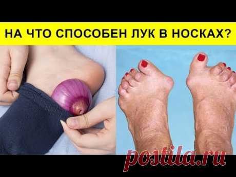 На что способен лук в носках на ночь? Как лук в носках может поменять вашу жизнь?