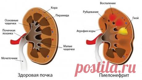 Стол 7а: показания к назначению, советы от специалистов