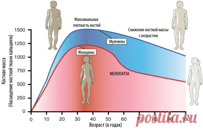 Что такое остеопороз и почему он возникает?

В России остеопорозом страдают каждая 3-я женщина и каждый 4-ый мужчина старше 50 лет, а в группу риска остеопоротических переломов входят 34 миллиона человек, из них у 14-ти миллионов имеется остеопороз, а у 20 миллионов – остеопения.