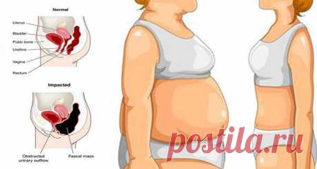 WEIGHT LOSS Archives - Page 3 of 3 - Healthy Life Always