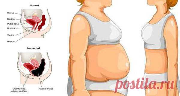 WEIGHT LOSS Archives - Page 3 of 3 - Healthy Life Always