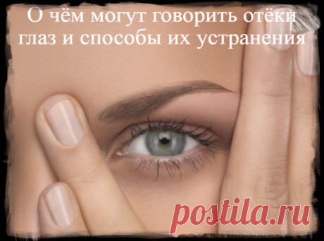 О чём могут говорить отёки глаз и способы их устранения
