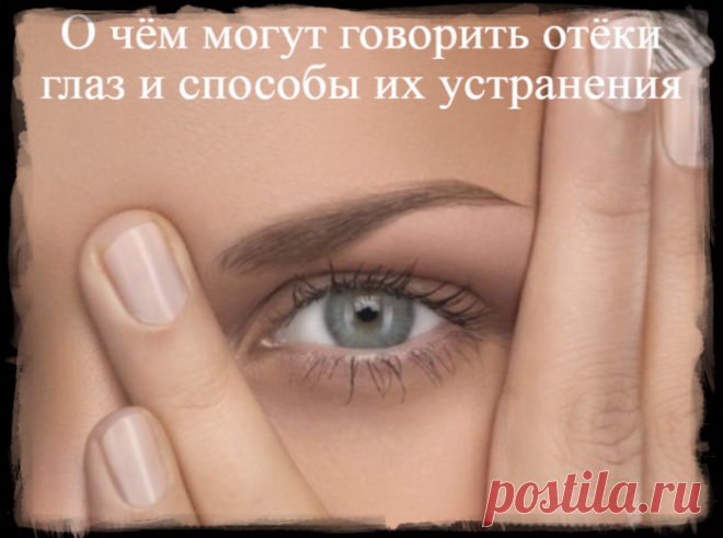 О чём могут говорить отёки глаз и способы их устранения