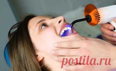 Пломбы опасны для зубов, выяснили специалисты