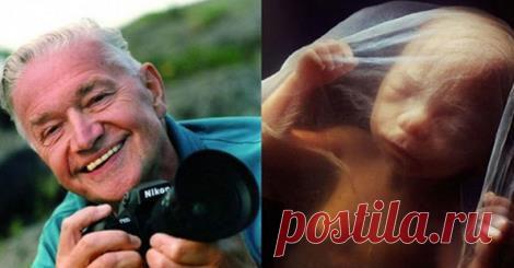 Facebook.Ребёнок от зачатия до рождения