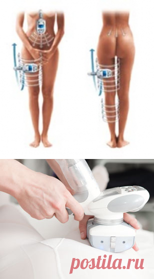 Что такое вакуумный массаж LPG?