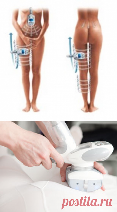 Что такое вакуумный массаж LPG?