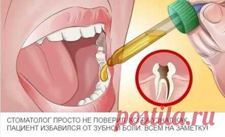 СТОМАТОЛОГ ПРОСТО НЕ ПОВЕРИЛ, КОГДА УЗНАЛ КАК ПАЦИЕНТ ИЗБАВИЛСЯ ОТ ЗУБНОЙ БОЛИ