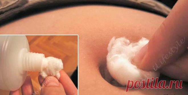 Засуньте ватный шарик себе в пупок - и уйдут кашель, простуда и менструальные боли! Народный метод, который 100% работает. Это может показаться невероятным, но большинство людей может если не избавиться от гриппа, простуды, насморка, кашля и болей при менструации в животе насовсем, то хотя бы облегчить симптомы. И это очень просто! Смочите обычный ватный шарик в 50-процентном спирте и поместите пропитанный ватный тампон себе в пупок. Это лекарство мгновенно вас расслабит, и боль — …