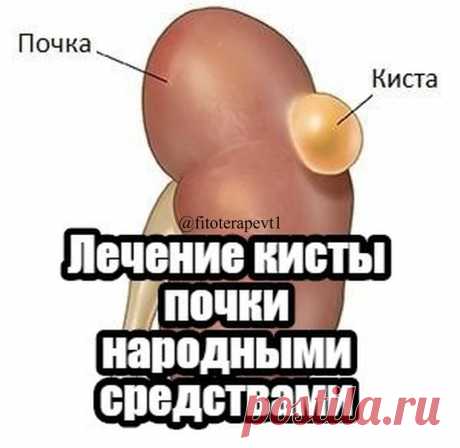 Полезные советы🌿 в Instagram: «Лечение кисты почки народными средствами ⠀ Возможно ли лечение кисты почки народными средствами? На этот вопрос можно ответить…»