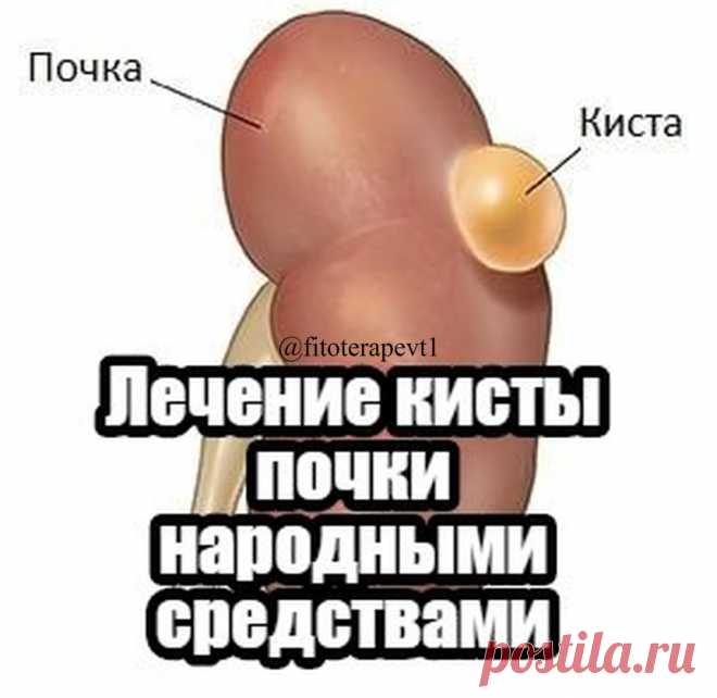 Полезные советы🌿 в Instagram: «Лечение кисты почки народными средствами ⠀ Возможно ли лечение кисты почки народными средствами? На этот вопрос можно ответить…»
