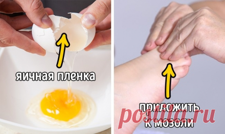 11 легких способов вылечить мозоль от неудобной обуви