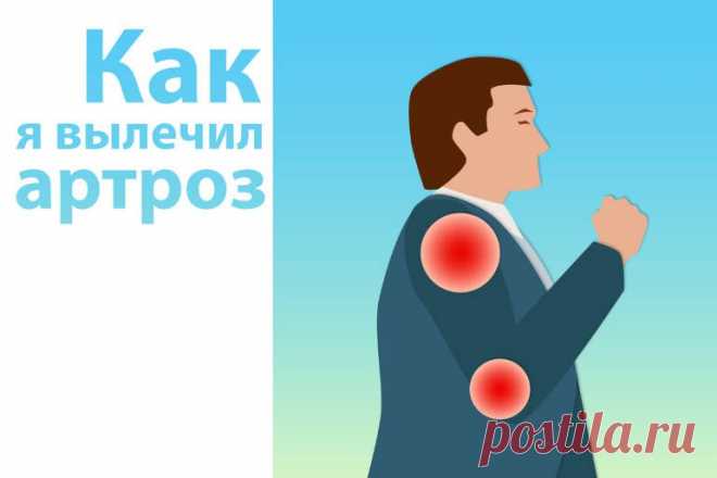 Как я вылечил артроз. | Сообщество Здоровых Людей.
