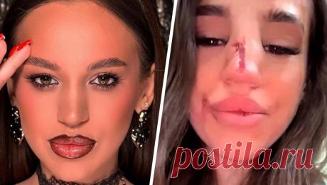 &quot;Не могу выйти на улицу&quot;: избитая в Челябинске хостес рассказала, что ее обидчика до сих пор ищут. Девушку-промоутера одного из челябинских баров избил гость, которого не пропустила охрана. Пострадавшая Ирина Сердюк рассказала &quot;Газете.Ru&quot;, что мужчину не пустили в бар из-за неадекватного состояния. Она отметила, что после ...