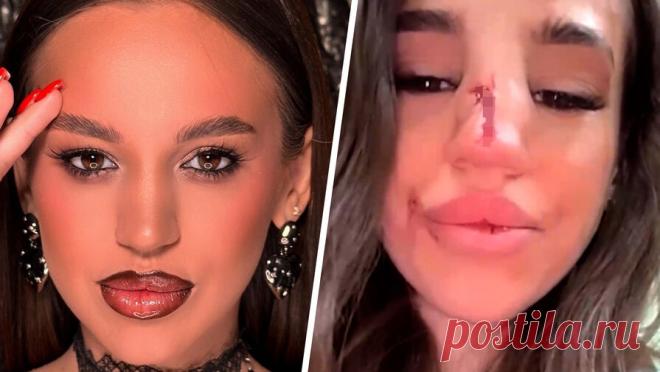 "Не могу выйти на улицу": избитая в Челябинске хостес рассказала, что ее обидчика до сих пор ищут. Девушку-промоутера одного из челябинских баров избил гость, которого не пропустила охрана. Пострадавшая Ирина Сердюк рассказала "Газете.Ru", что мужчину не пустили в бар из-за неадекватного состояния. Она отметила, что после ...