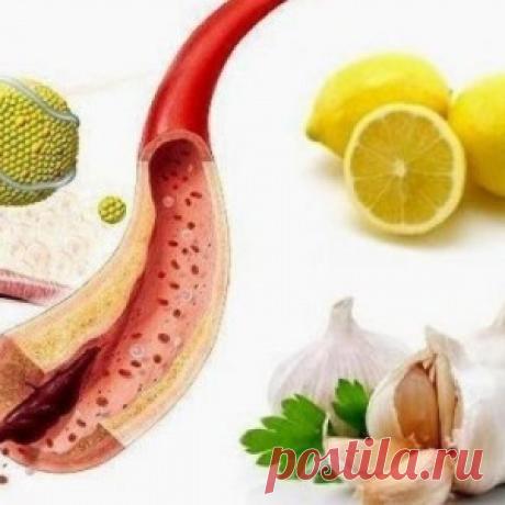 Этот мощный домашний напиток очищает артерии и предупреждает сердечный приступ! - МирТесен