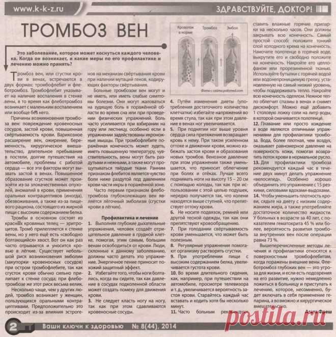 Тромбоз вен