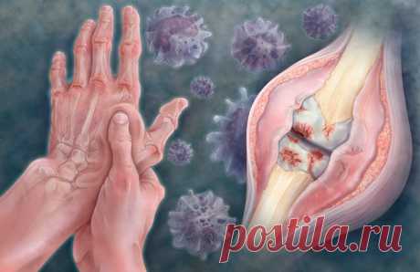 Пищевые добавки от боли в суставах и связках