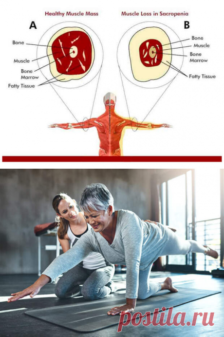 Что нужно знать о САРКОПЕНИИ-МЫШЕЧНАЯ СЛАБОСТЬ-СТАРЕНИЕ