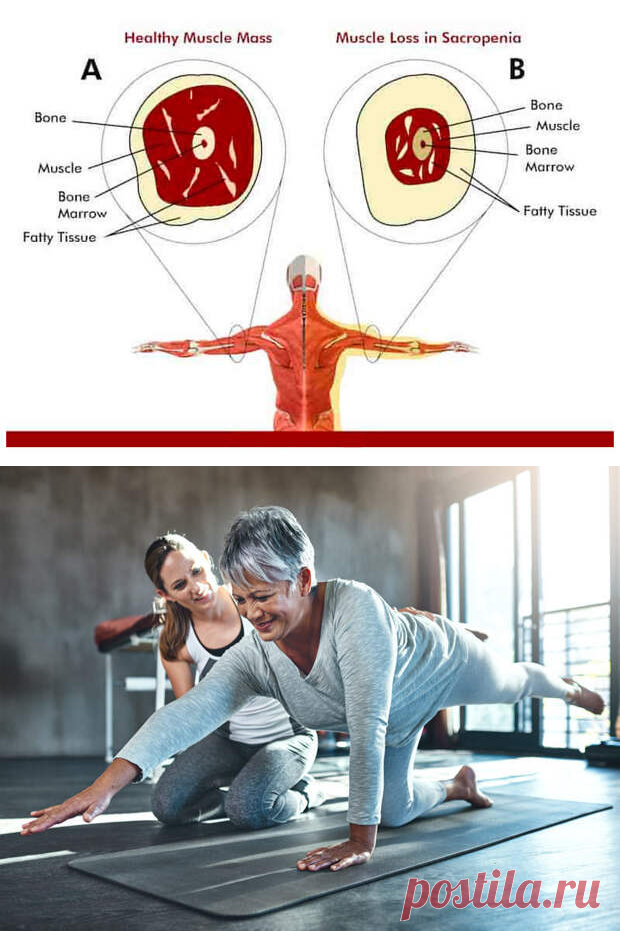 Что нужно знать о САРКОПЕНИИ-МЫШЕЧНАЯ СЛАБОСТЬ-СТАРЕНИЕ