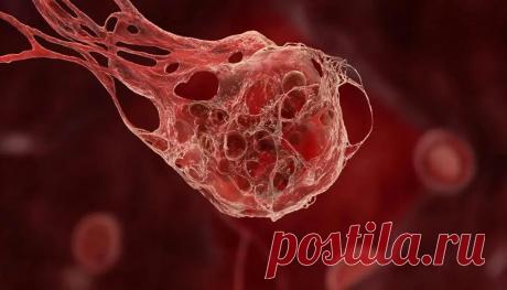 Свёртывание крови: что это такое, этапы и схема механизма гемостаза