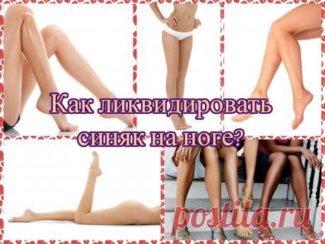 Как ликвидировать синяк на ноге? Читайте у нас!