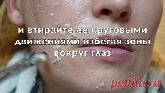 У меня Нет Морщин! Делаю Это Раз в неделю- и Мое ЛИЦО Выглядит на 10 лет Моложе! 🎈У меня Нет Морщин! Делаю Это Раз в неделю- и Мое ЛИЦО Выглядит на 10 лет Моложе!🎈САМОМАССАЖ лица и шеи. Подробное видео! Омоложение лица!---https://youtu....