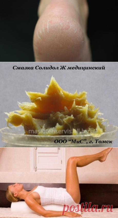 7 способов сделать пятки, как у младенца. Забудь про сухость и трещины!