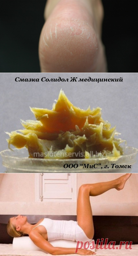 7 способов сделать пятки, как у младенца. Забудь про сухость и трещины!
