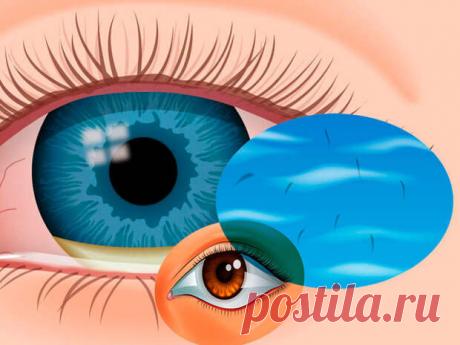 Мушки в глазах: Почему появляются и что делать?
Глазные поплавки или мушки — это пятна, движущиеся через ваше поле зрения.  Они могут выглядеть черными или серыми, волнистыми или похожими на паутину, они могут двигаться, дрейфовать или метаться, когда вы двигаете глазами.  Многие глазные поплавки вызваны возрастными изменениями в глазах.  Если глазные поплавки появляются и увеличиваются быстро или внезапно, вам следует немедленно обратиться к […]
Читай пост далее на сайте. Жми ⏫ссылку выше