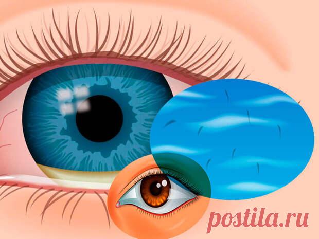 Мушки в глазах: Почему появляются и что делать?
Глазные поплавки или мушки — это пятна, движущиеся через ваше поле зрения.  Они могут выглядеть черными или серыми, волнистыми или похожими на паутину, они могут двигаться, дрейфовать или метаться, когда вы двигаете глазами.  Многие глазные поплавки вызваны возрастными изменениями в глазах.  Если глазные поплавки появляются и увеличиваются быстро или внезапно, вам следует немедленно обратиться к […]
Читай дальше на сайте. Жми подробнее ➡