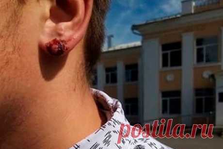 Директор российской школы порвал ухо ученику за отказ снять серьгу. В одной из школ в Рыльском районе Курской области директор школы порвал ухо ученику, который отказывался снять серьгу. По словам ученика, он пришел в школу 2 сентября, и его сразу же попросили пройти в кабинет директора Александра Андрощика. На следующий день в учебное заведение пришла мать школьника.