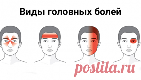 Голова болит по-разному! Не пропусти опасный симптом!