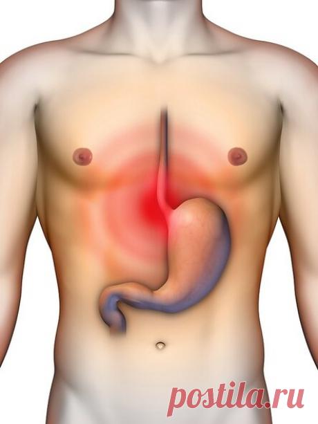 Рефлюкс-эзофагит