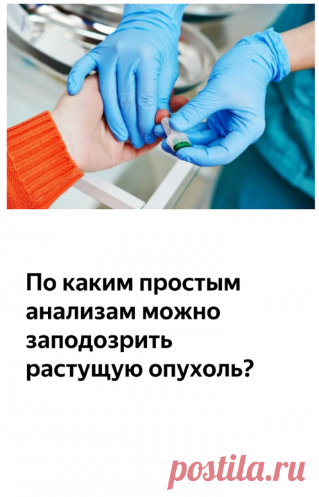 По каким простым анализам можно заподозрить растущую опухоль? | Айболит. Блог хирурга | Яндекс Дзен