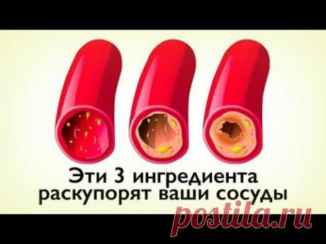 КАК ОЧИСТИТЬ СОСУДЫ С ПОМОЩЬЮ 3-Х ПРОДУКТОВ?