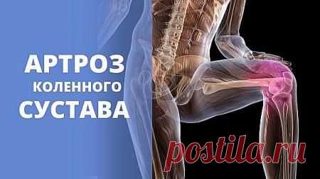 Лечение артроза коленного сустава от Бубновского