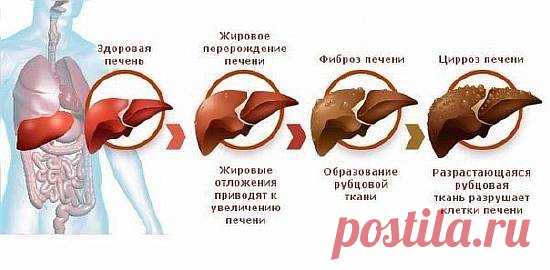 Как ухаживать за своей печенью