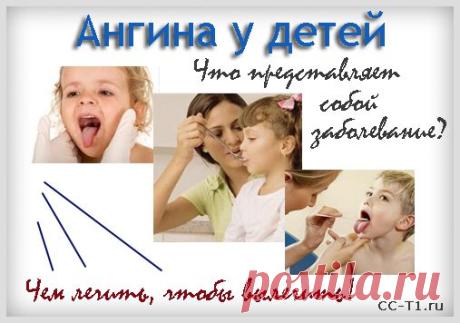 Ангина у детей - лечение и симптомы. Секреты лечения ребенка с различными формами ангин и тонзиллитов