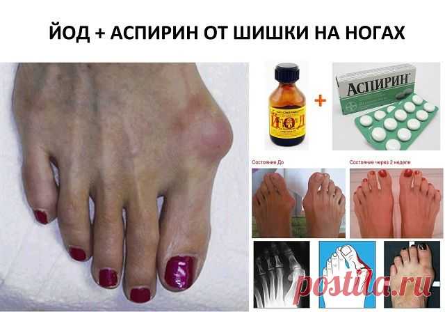 (49) Одноклассники