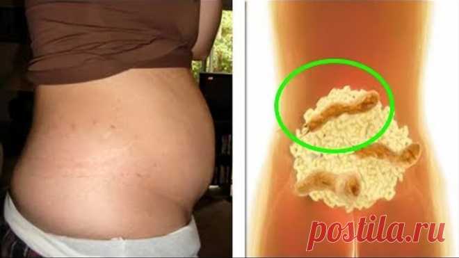 КАК Я Вычистила КИШЕЧНИК и ПОТЕРЯЛА 11 кг !!! СКРАБ для КИШЕЧНИКА!!!